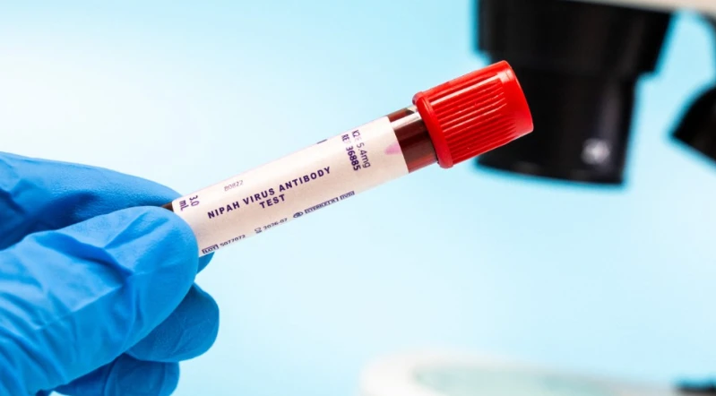 ニパウイルス | インドで発生、複数の国が健康監視を強化。このウイルスは人から人へ感染し、死亡率は最大 75% に達する。